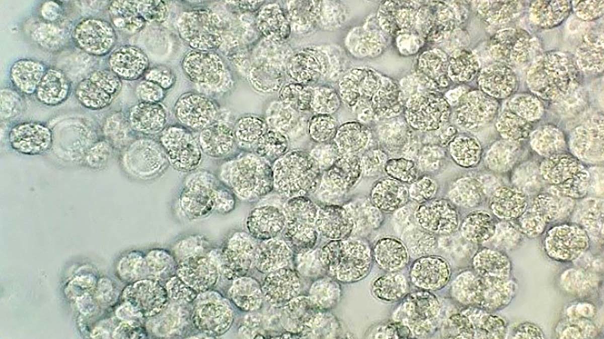 Mikroskopisches Bild von Mikroalgen
